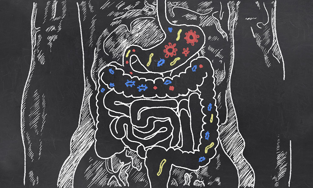 Picture of drawn stomach and gut